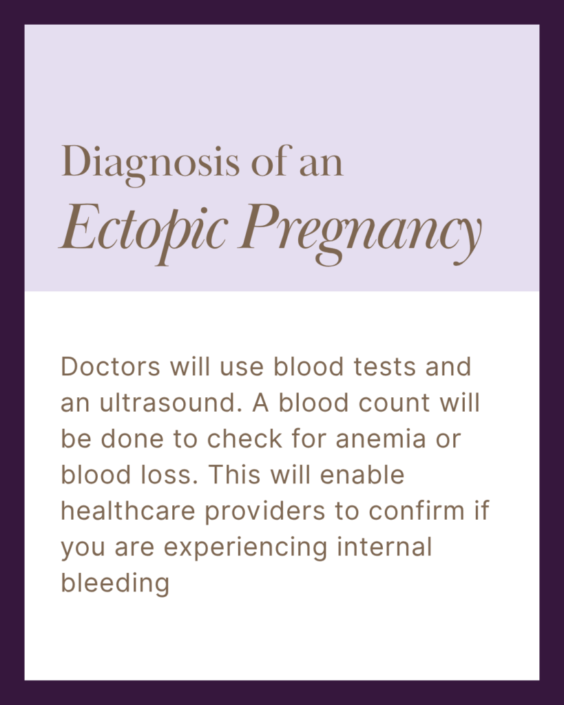 Diagnosis of n Ectopic Pregnancy
